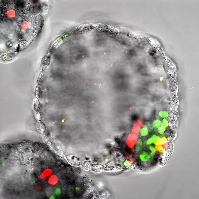 Human Blastocyst Like Synthetic Embryo Called Blastoid