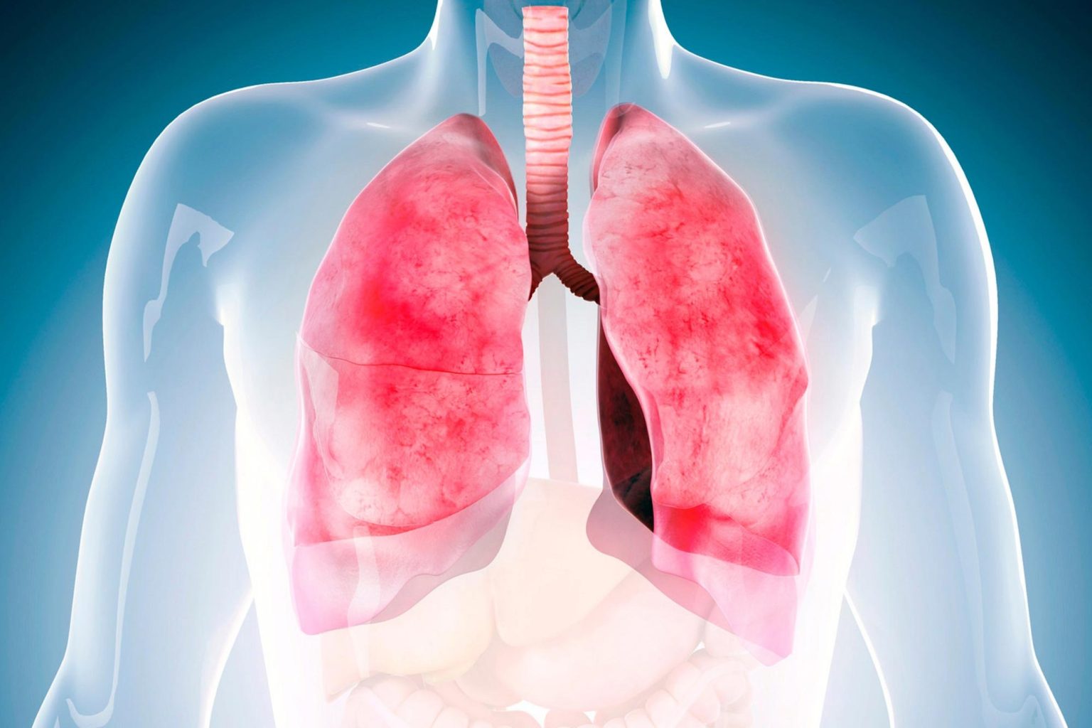 Combined Treatment Strategy Critical to Minimizing LongTerm Lung