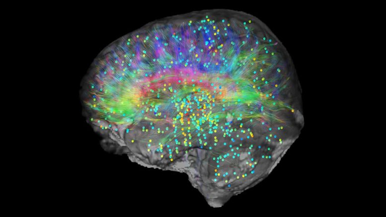 Human Brain Consciousness