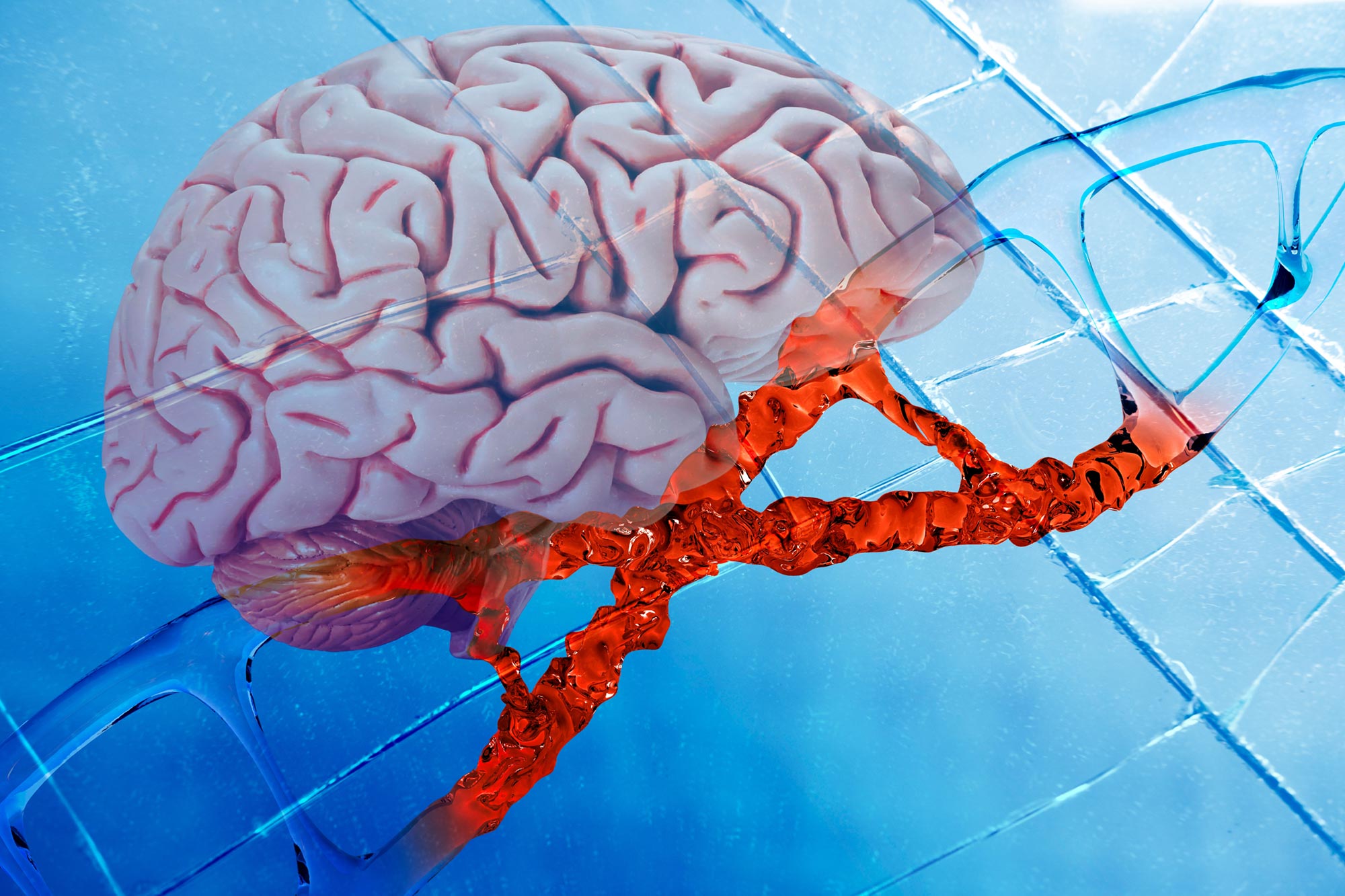 Scientists Flip an Alzheimer’s Risk Gene – and Reverse Key Hallmarks of the Disease