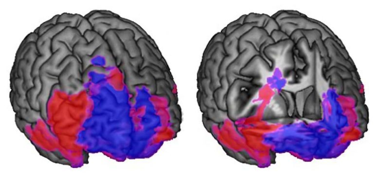 Human Brain Decision Making and Behavioral Control Regions MRI Scans