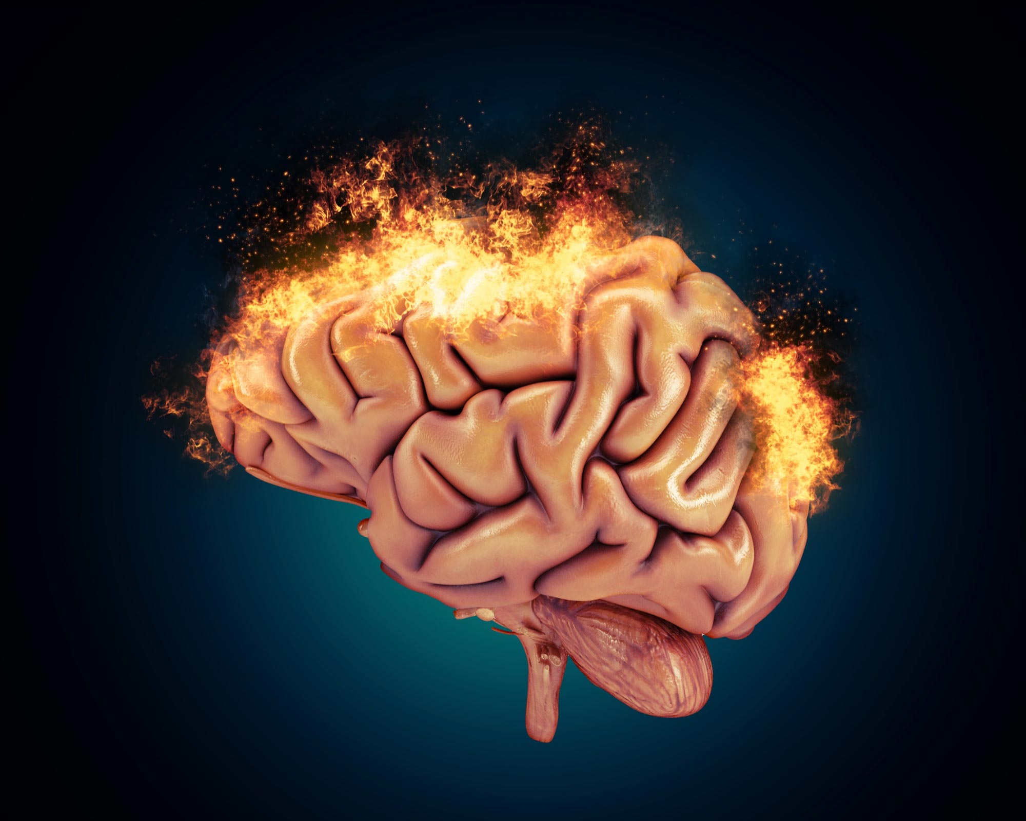 人間の脳の火災損傷痛みの概念