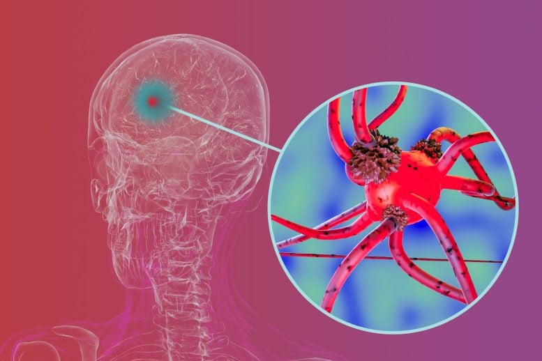 Widely Used Farm Chemical May More Than Double Parkinson’s Disease Risk