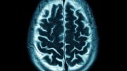 Human Brain Scan MRI Image