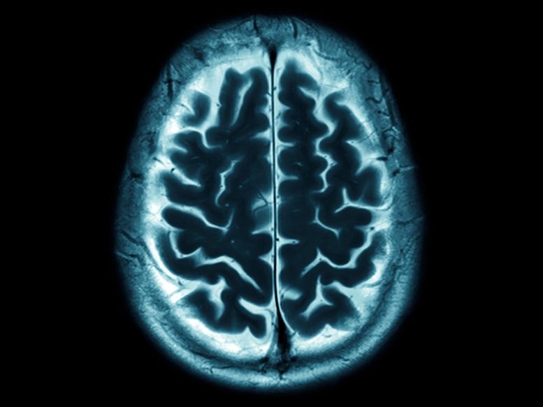 Human Brain Scan MRI Image