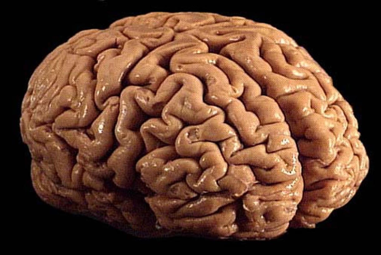 Human Brain Surface Folding