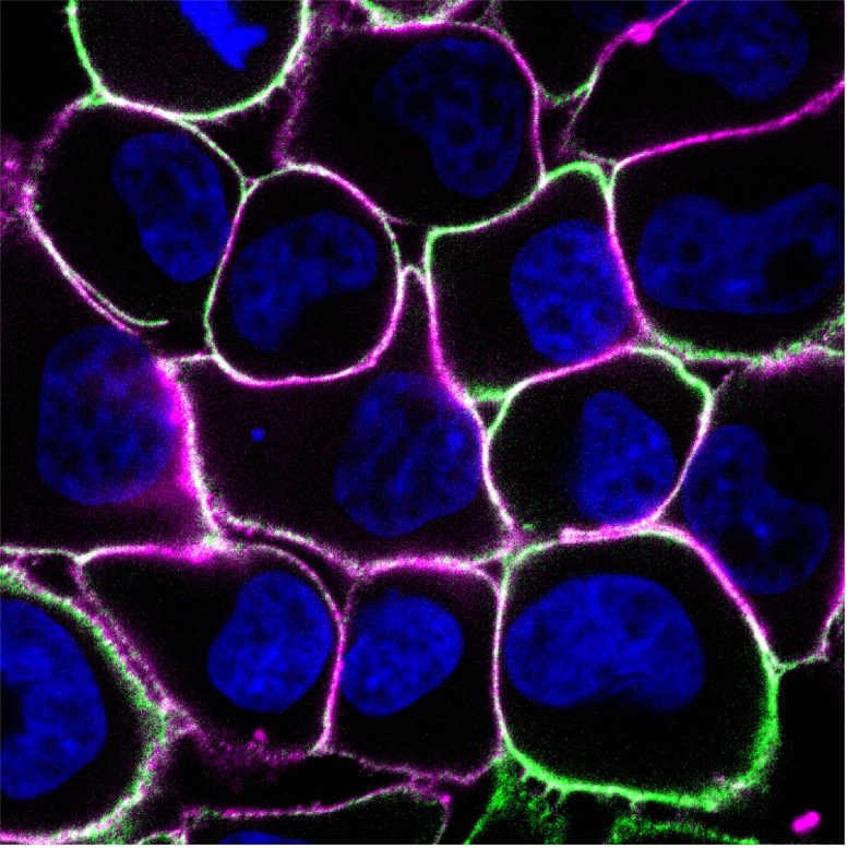 Human Breast Cancer Cells