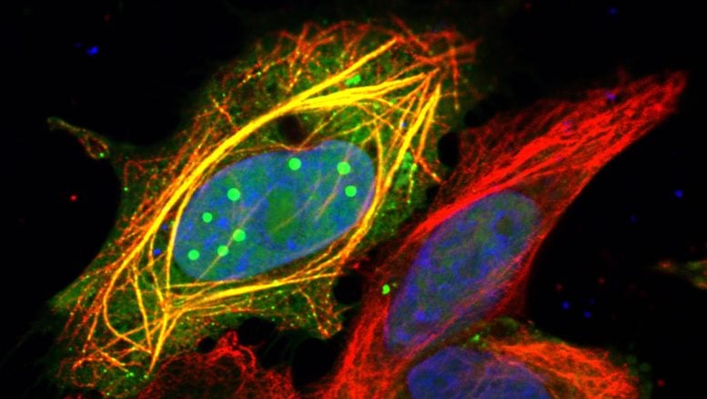 Scientists Just Discovered How Rabies Hijacks Human Cells