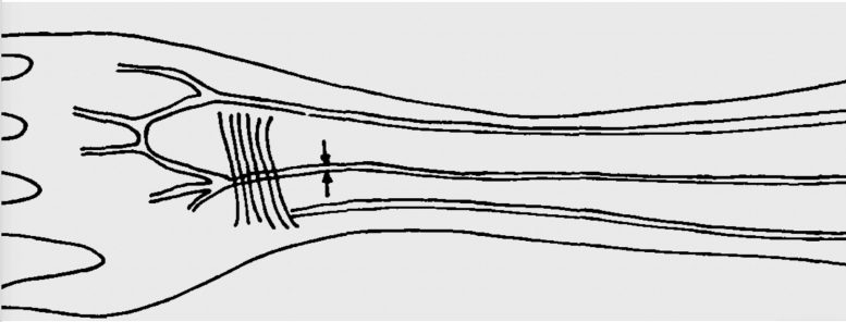Human Forearm Median Artery