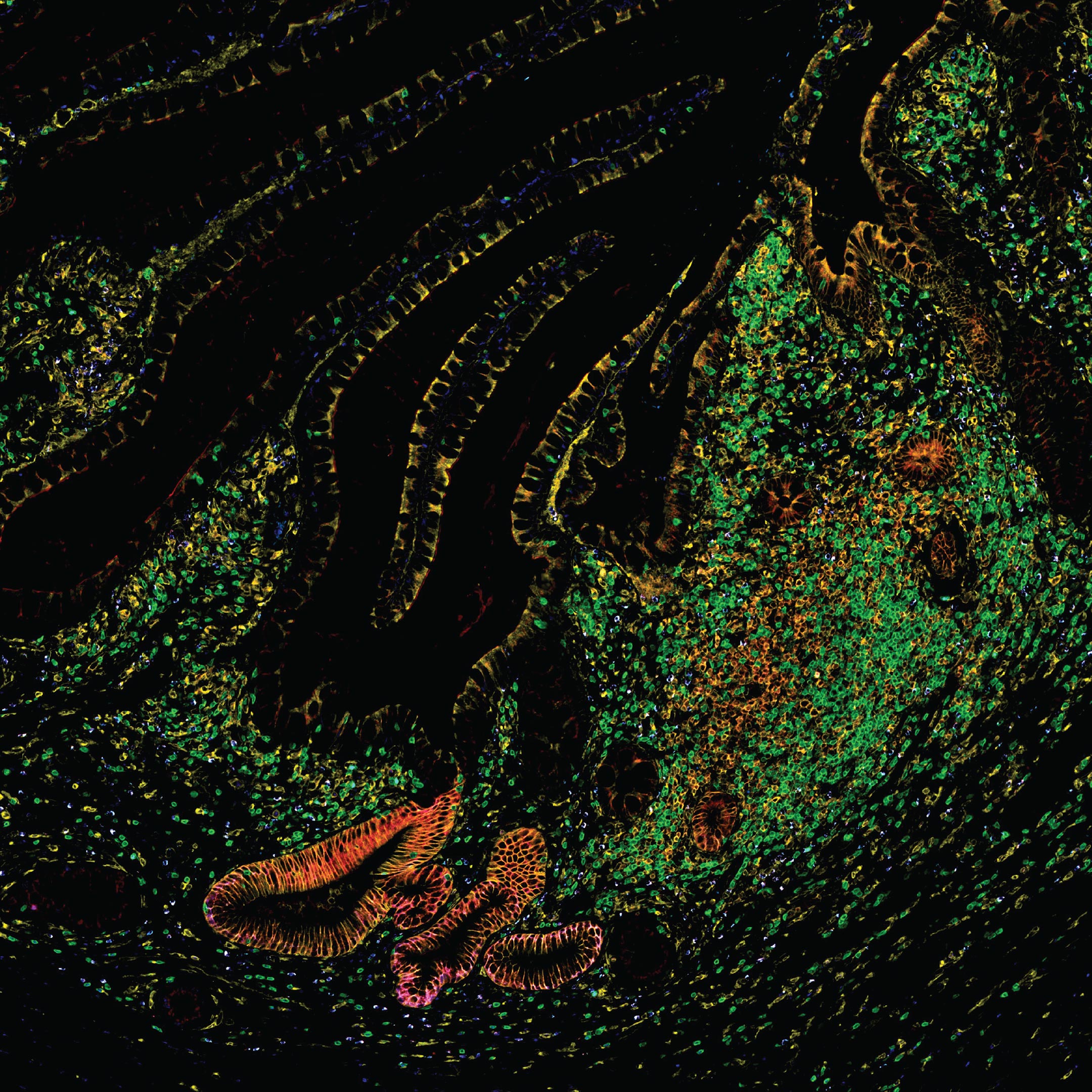 E120 And Inflammation: The Hidden Link - j19wske