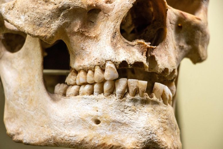Human Jaw Teeth Skull