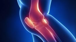 Human Knee Pain Skeleton