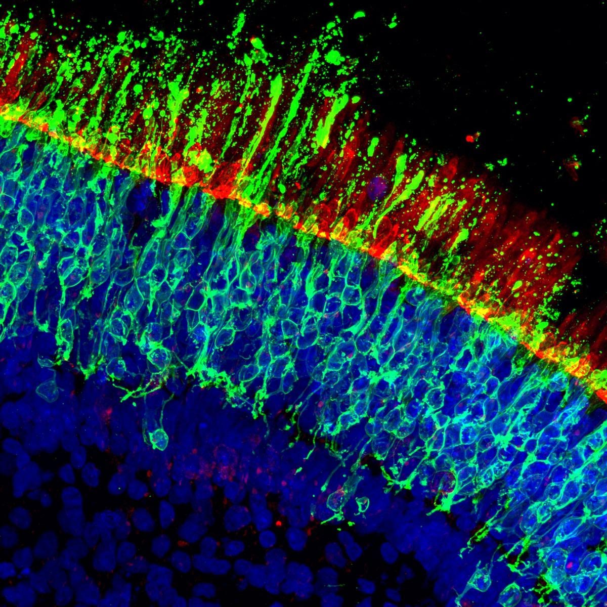 Scientists Discover How to Stop Vision Loss Before It Starts - SciTechDaily