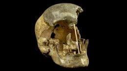 Human Skull From Zlatý Kůň