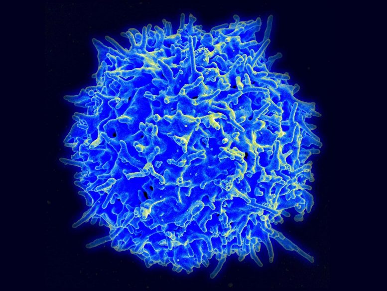 Human T Lymphocyte Cell