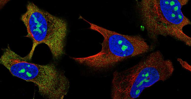 Human U2OS Cell