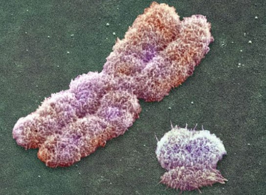 Human Y Chromosome Much Older Than Previously Thought