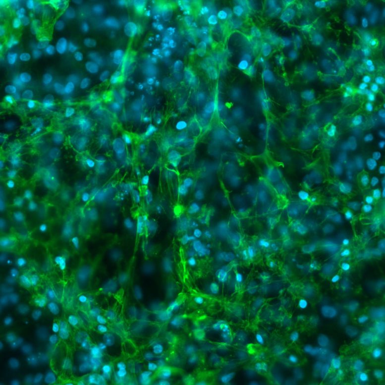 Human iPSC Derived Cardiomyocytes