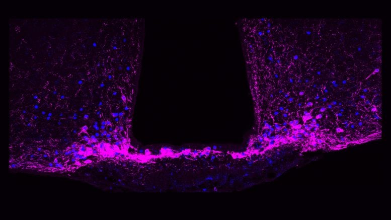 Neuroni della fame nel nucleo arcuato dell'ipotalamo