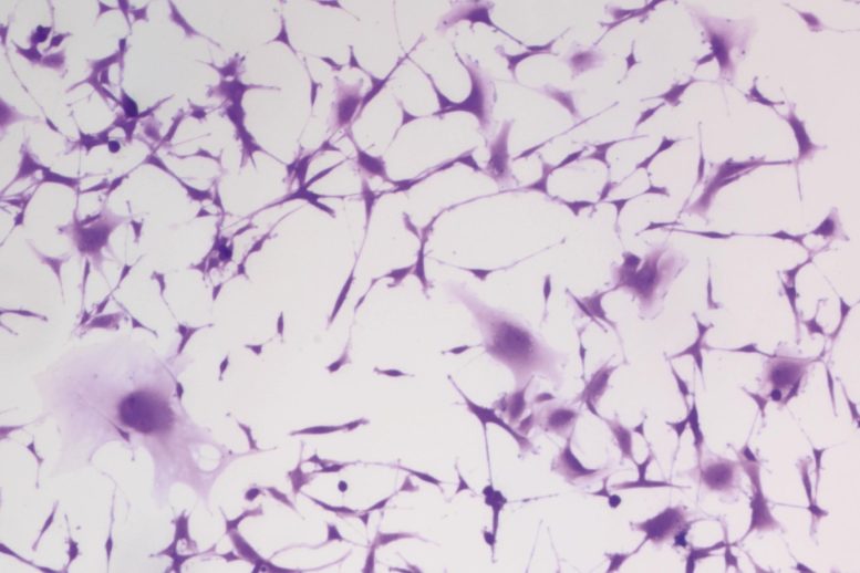 Hydralazine Treated Glioblastoma Cells Showing Senescence