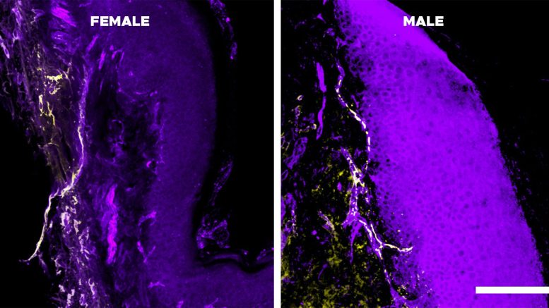 IL 10 Receptor Subunit Levels (Yellow) in Female (Left) vs. Male (Right)