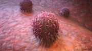 Illustration of Cancer Cells