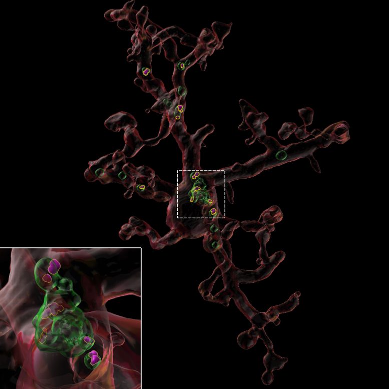 Image Reconstruction of Microglia From an Aged Mouse Treated With TIMP2
