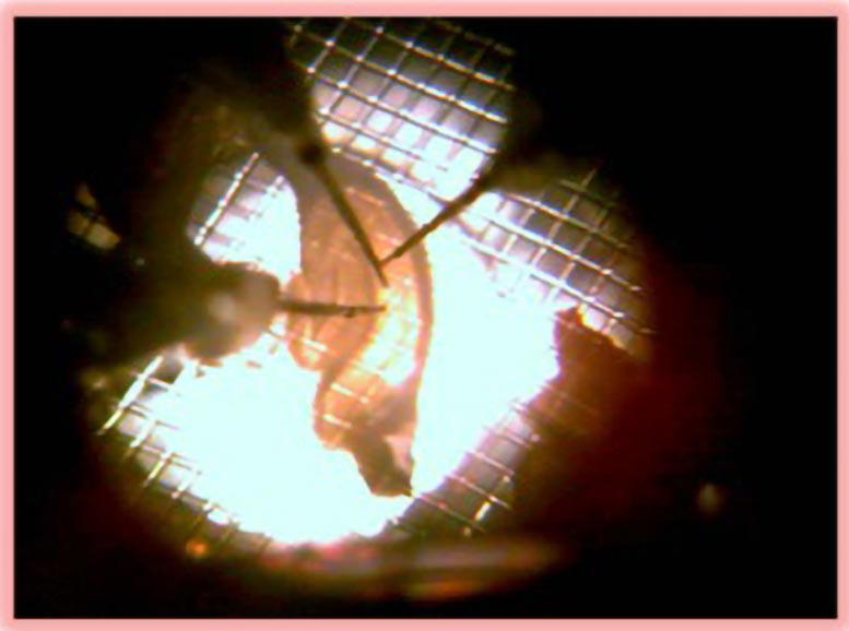 Image of Hippocampal Slices With Electrodes Inside Them