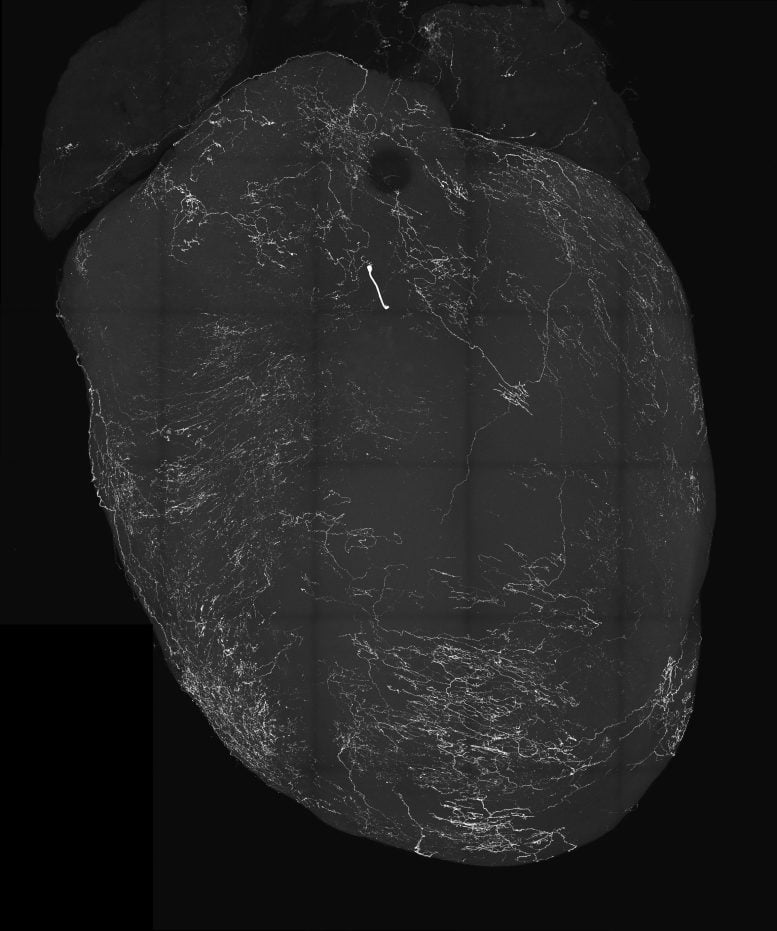 Image of a Heart Labeled by Vagal Sensory Neurons