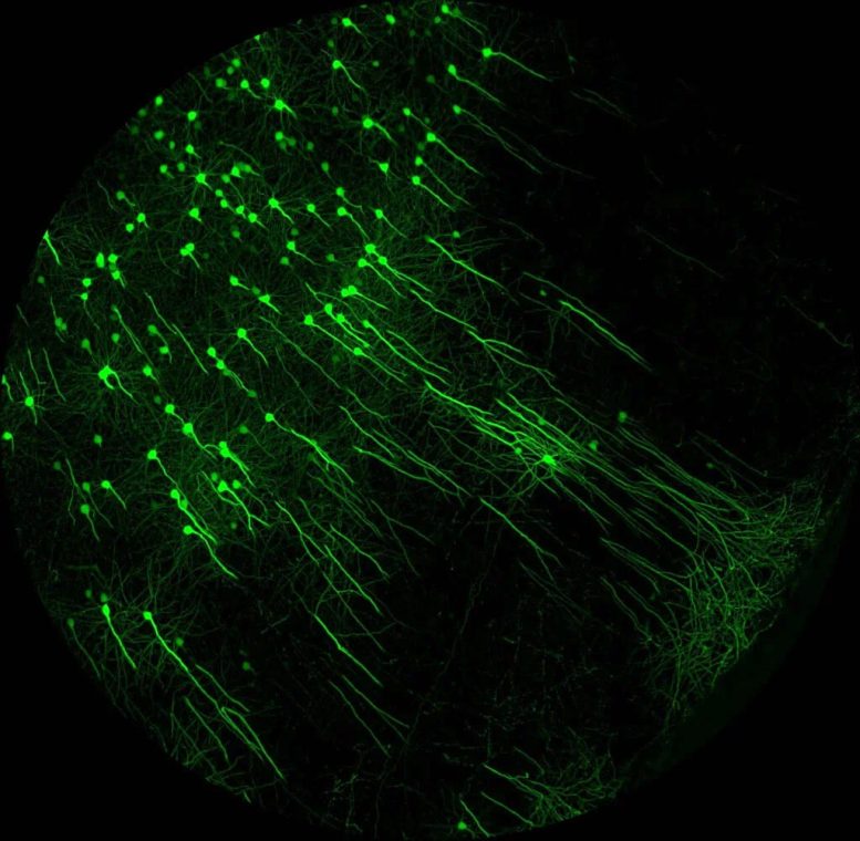 Imaging Neurons