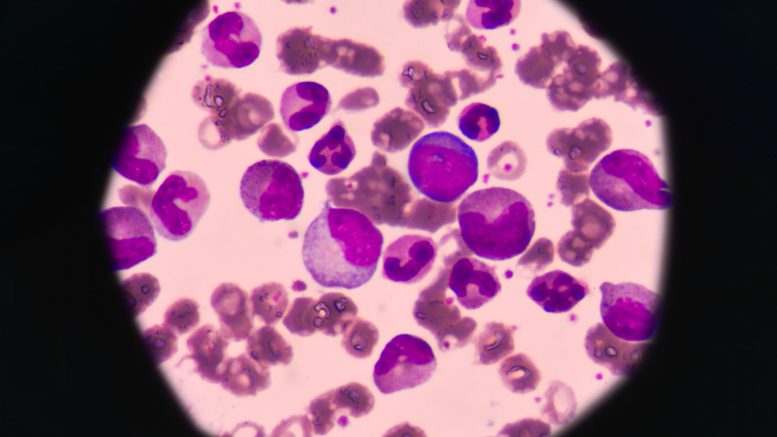 View of A Natural Compound That Can Help Cure Leukemia