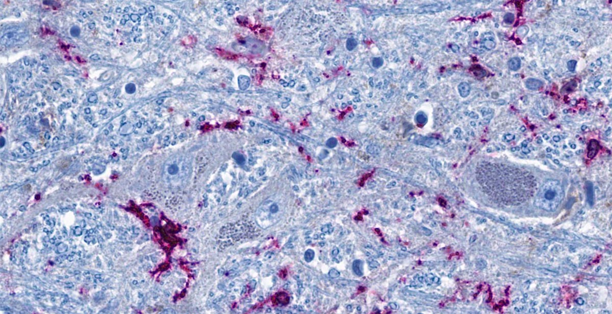 Immune-Cells-Brainstem-Cross-Section.jpg