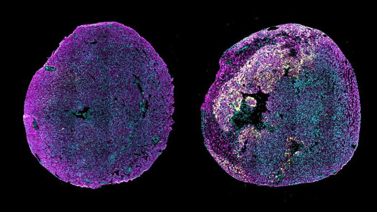 Immunofluorescence Image of Transverse Heart Sections