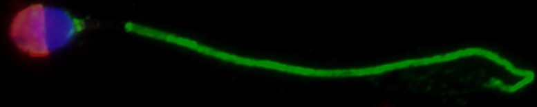 Immunofluorescence Microscopy of Sperm Cells and Testicular Tissues