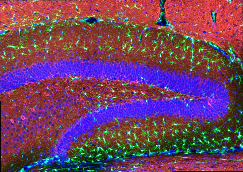 Implanted Human Microglia in Mouse Hippocampus Tissue