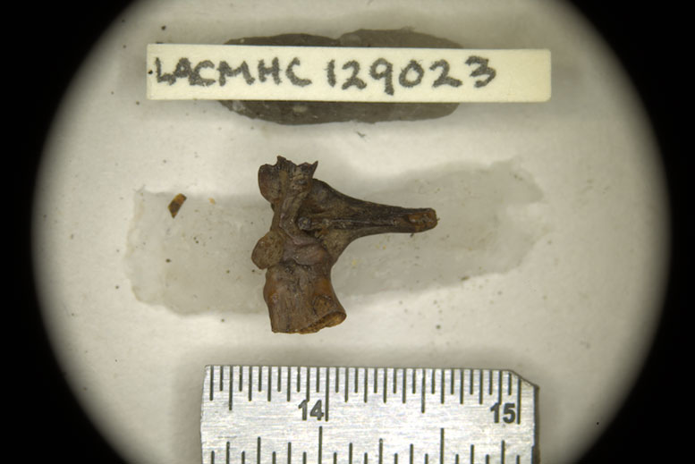 Incomplete Sacro Urostyle Bone