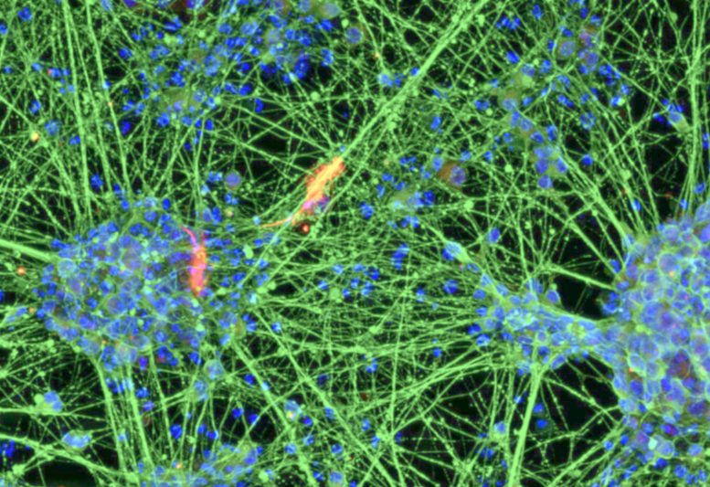Induced Neural Stem Cells (iNSCs) Derived From Blood