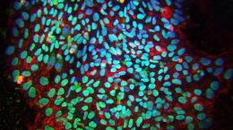 Induced Pluripotent Stem Cells Colony
