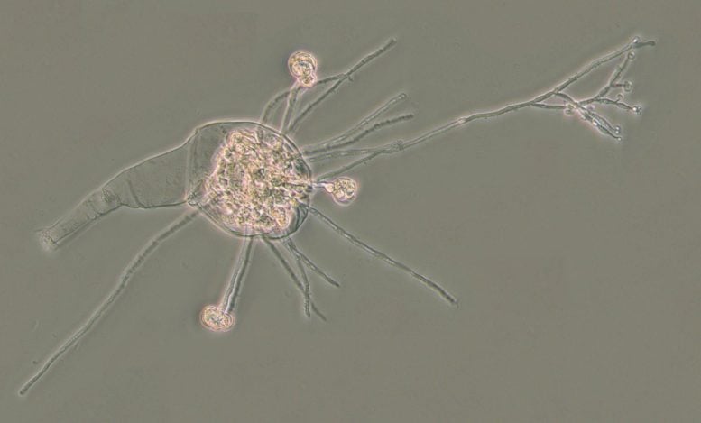 Infected Bdelloid Rotifer