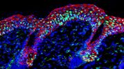 Inflamed Mouse Stem Cells