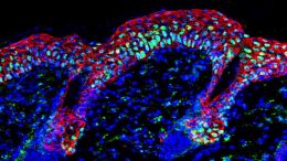 Inflamed Mouse Stem Cells