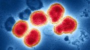 Influenza A Virus (H3N2)