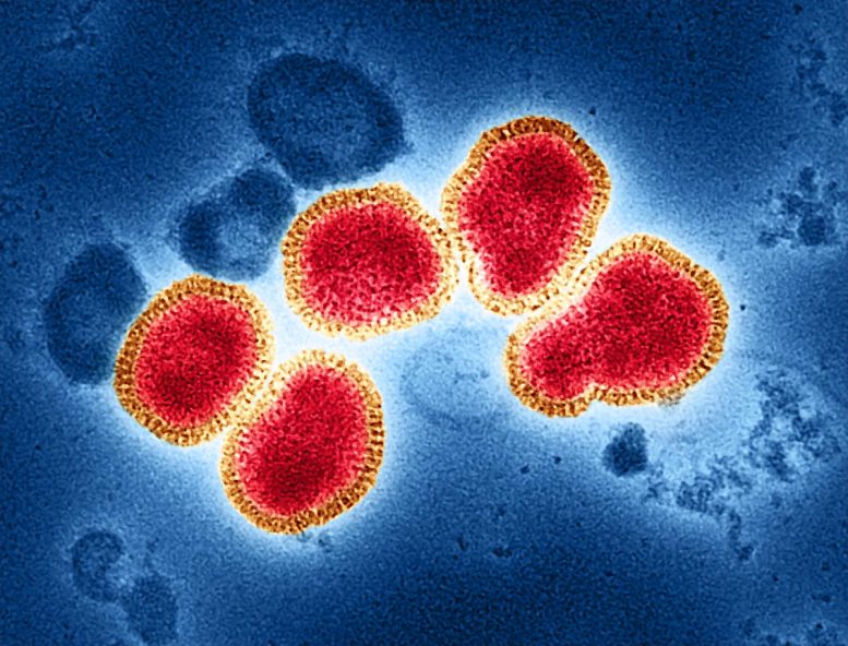 Influenza A Virus (H3N2)