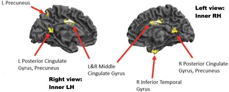 מבטים פנימיים של צד שמאל וימין של המוח