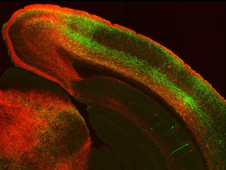Innervated Cortex Axons Neurons
