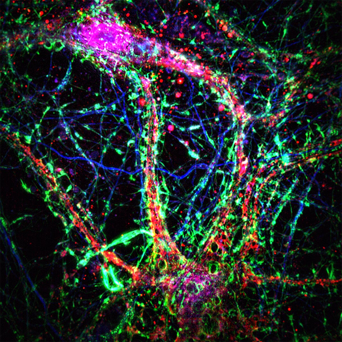 Tiny Brain Tubes Discovered by Johns Hopkins Could Explain Alzheimer’s