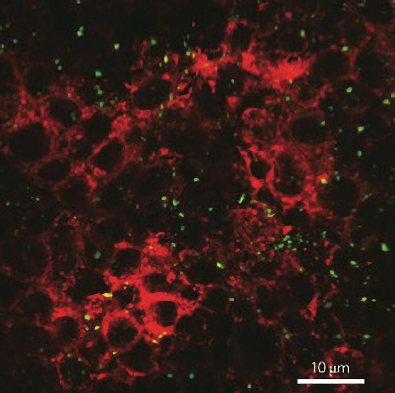 Intestinal Cell Monolayer After Exposure to Nanoparticles