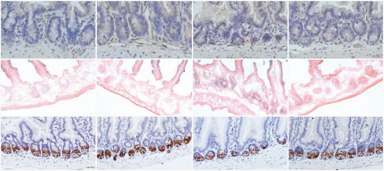 Intestinal Linings uPAR Targeting