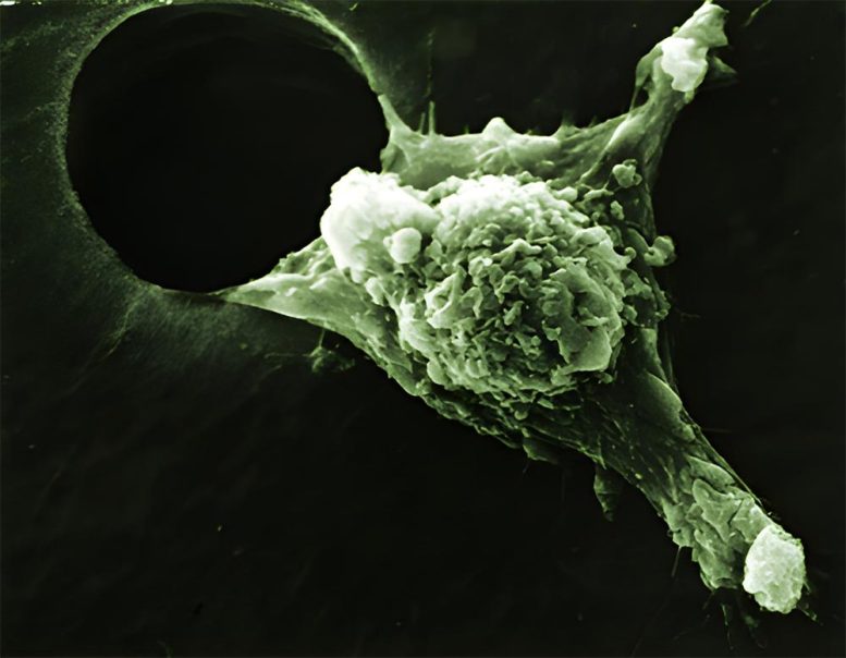 Invasive Cancer Cell Moves With Its Leading Edge