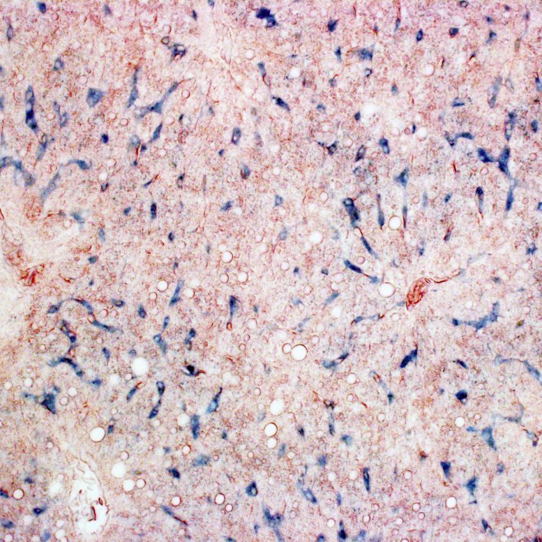 Iron in Pigeon Liver